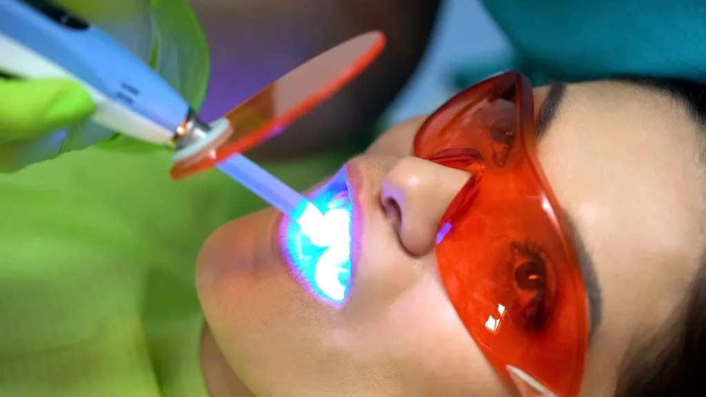 Procedimiento antes y después de los bonding dentales