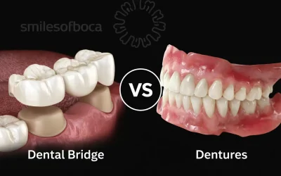 Puente dental vs dentaduras: ¿Cuál opción de reemplazo dental es la mejor para ti?