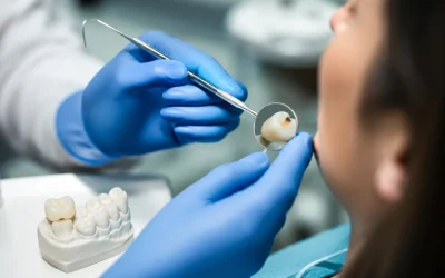 Corona dental astillada: ¿Reparar o reemplazar? Una guía para tomar una decisión el mismo día.