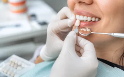 Temporary Veneers: 7 Things to Expect Before Your Final Smile