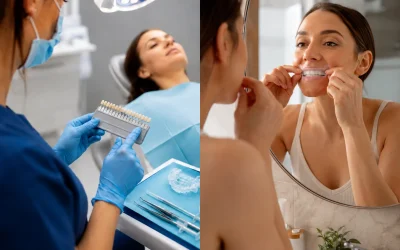 Professional Teeth Whitening vs At-Home Whitening: 7 Differences to Know